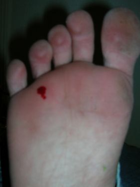 foot